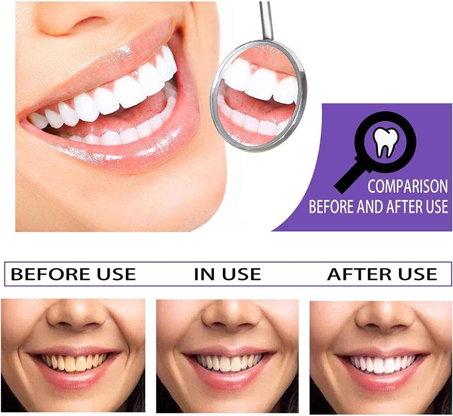 ITZZO Color Corrector Tooth Stain Removal